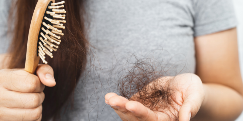 ریزش مو چیست