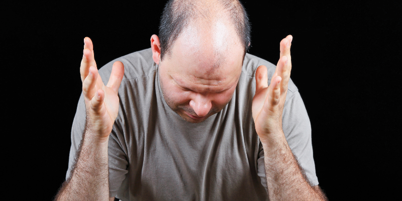 علت ریزش مو و درمان آن