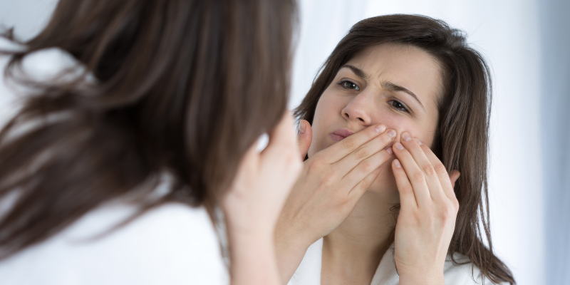 روتین پوست های خشک