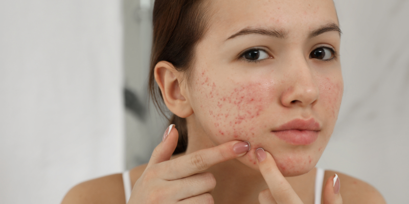 التهاب پوستی چیست؟