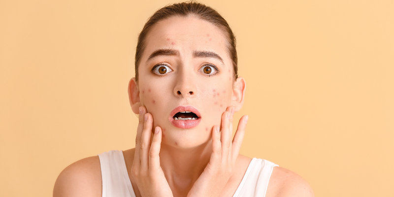 نکاتی برای کاهش التهاب پوست