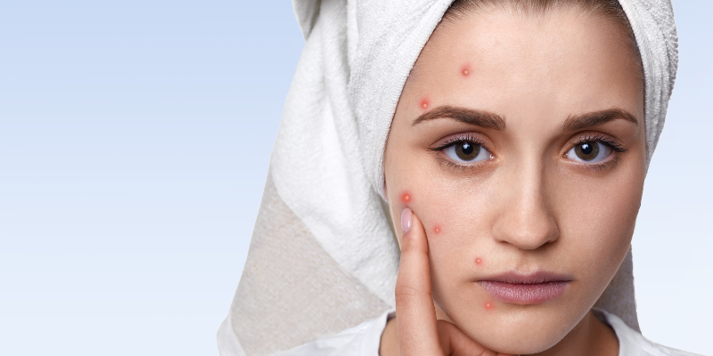 التهاب پوستی