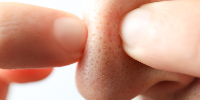 التهاب پوستی چیست؟