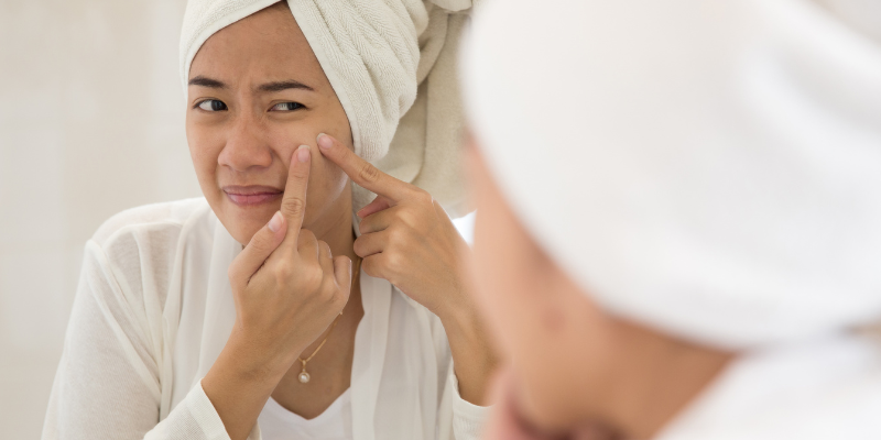 دمودکس و ایجاد جوش عصبی