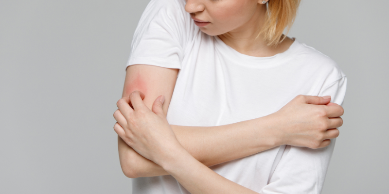 انواع بیماری های پوستی