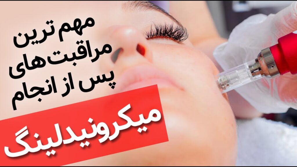 مراقبت های پس از میکرونیدلینگ