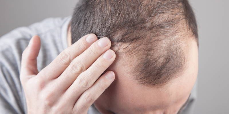 عوارض فیناستراید