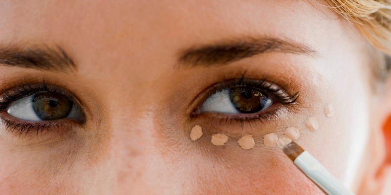 حلقه های تیره اطراف چشم