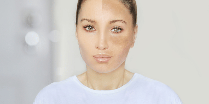 راه های ساده تر برای سفید کردن پوست