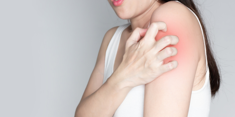 بیماری های رایج پوستی