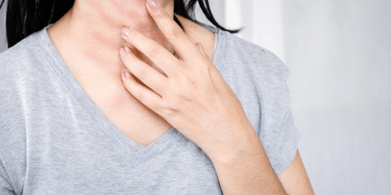 چگونه از خشکی پوست جلوگیری کنیم؟