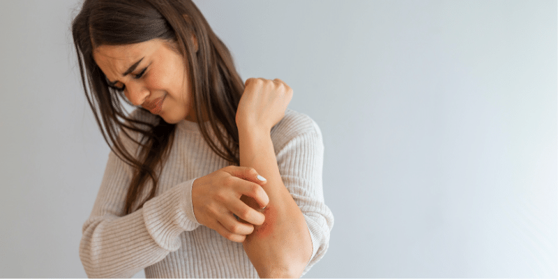 اگزما و بیماری های پوستی