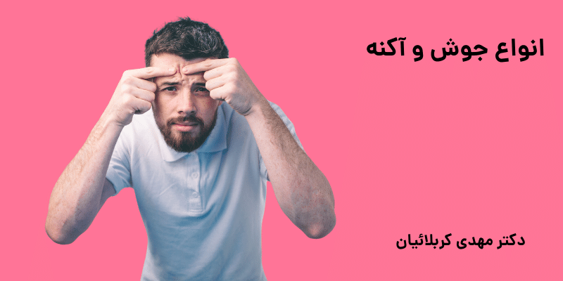 جوش و آکنه