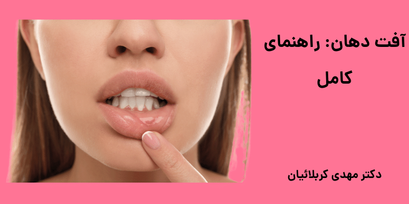آفت دهان_ راهنمای کامل