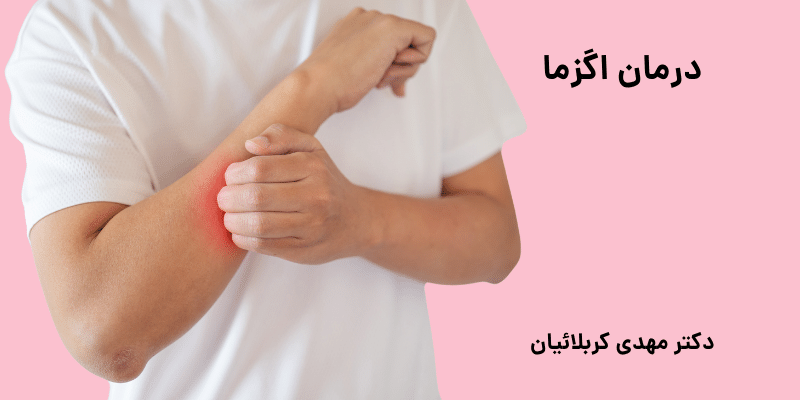 درمان اگزما