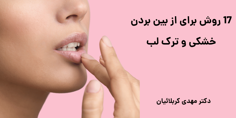 خشکی و ترک لب