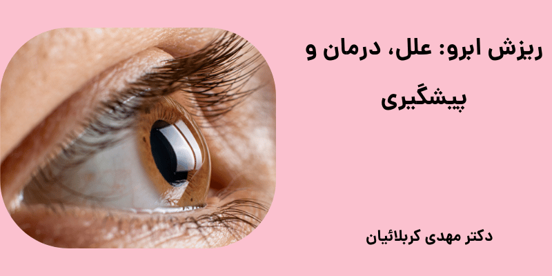 ریزش ابرو