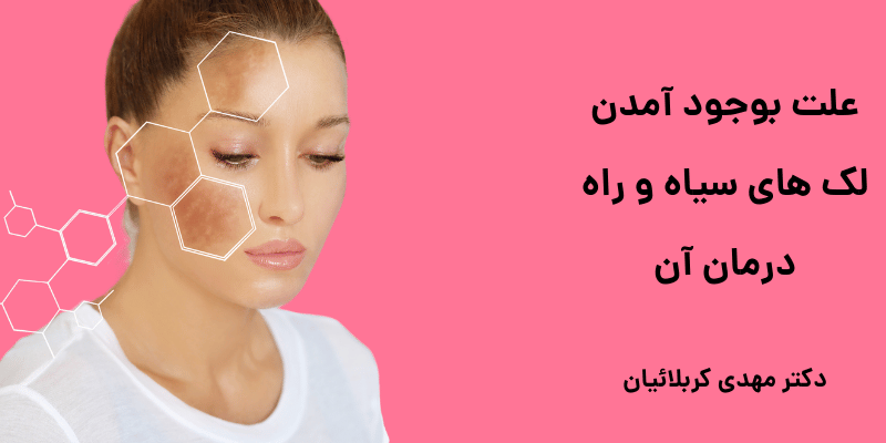 لک های سیاه