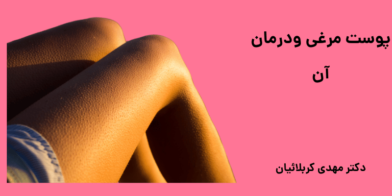 پوست مرغی