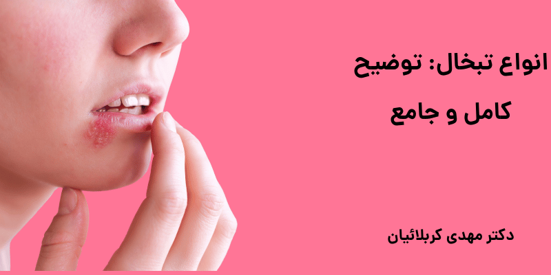 انواع تبخال