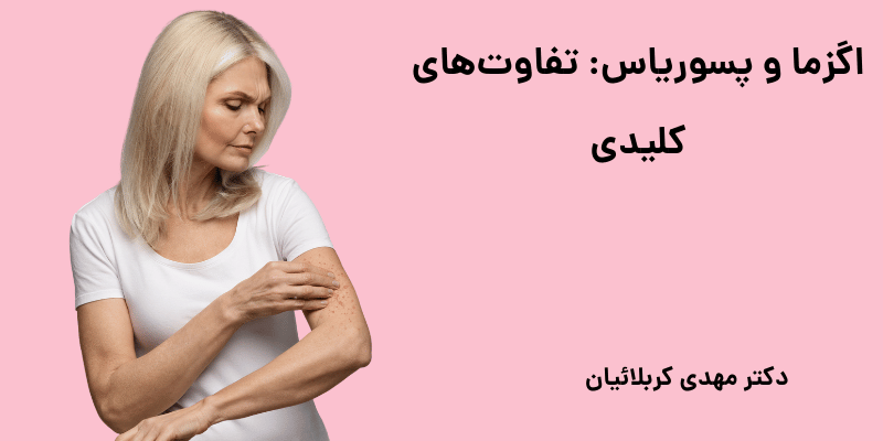 اگزما و پسوریاس
