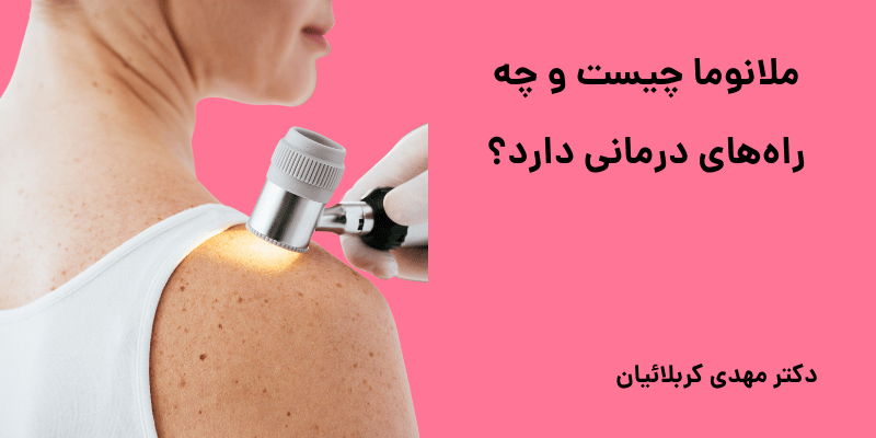 ملانوما چیست