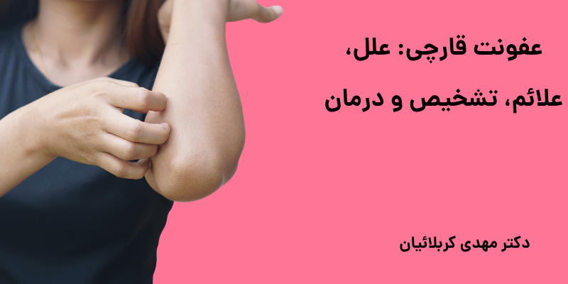 عفونت قارچی