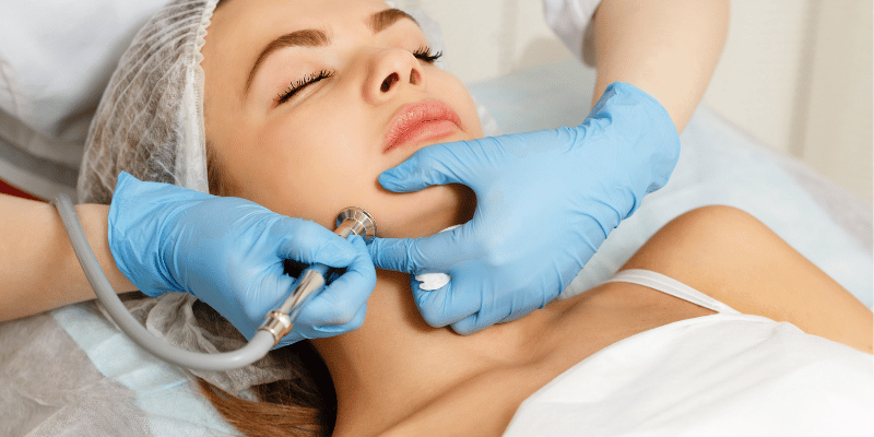 میکرودرم ابریژن چگونه انجام می‌شود؟