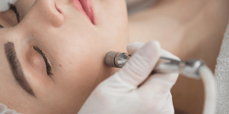 میکرودرم ابریژن چیست و چگونه عمل می‌کند؟