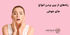 انواع جای جوش