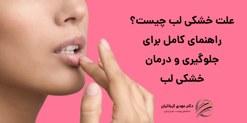 علت خشکی لب