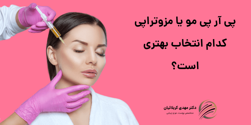 پی آر پی مو یا مزوتراپی