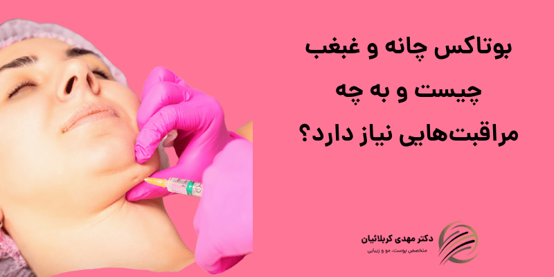 بوتاکس چانه و غبغب