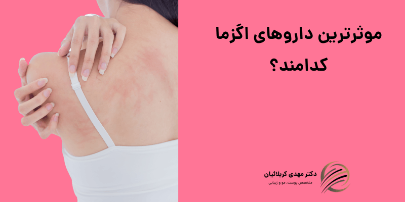 داروهای اگزما