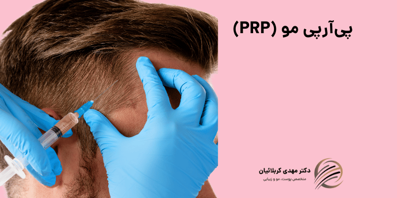 پی‌آر‌پی مو