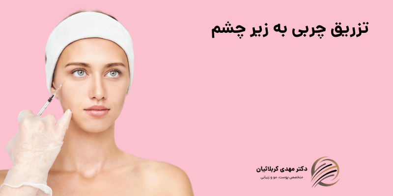 تزریق چربی به زیر چشم
