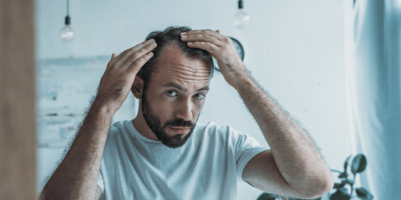 ارتباط بین استرس و ریزش مو