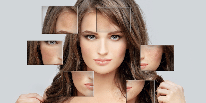 انواع لک‌های پوستی و دلایل ایجاد آن‌ها