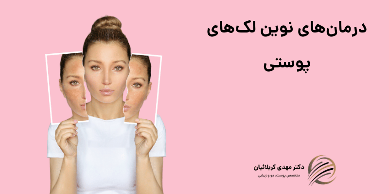 لک‌های پوستی