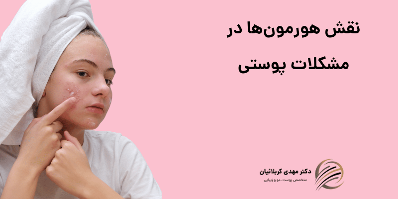 نقش هورمون‌ها در مشکلات پوستی