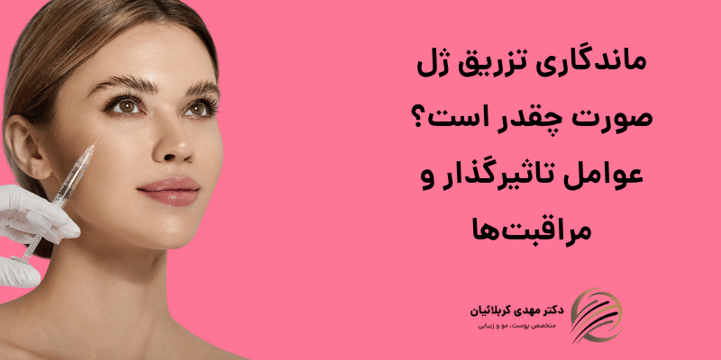 ماندگاری تزریق ژل صورت
