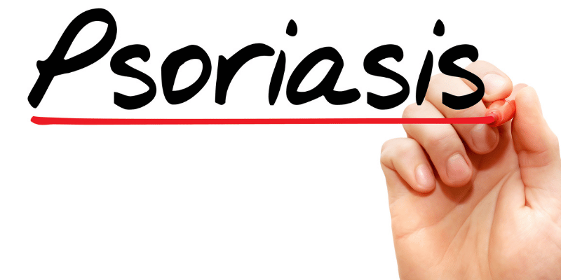 انواع پسوریازیس