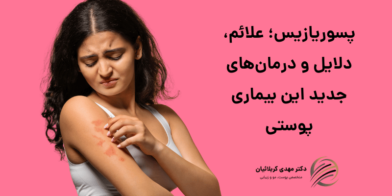 پسوریازیس چیست