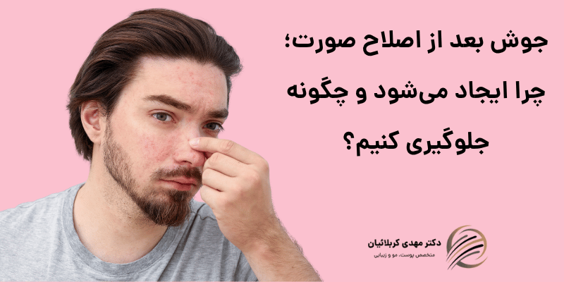 جوش بعد از اصلاح صورت