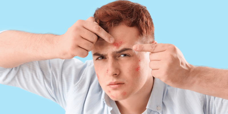 پیشگیری از جوش بعد از اصلاح صورت