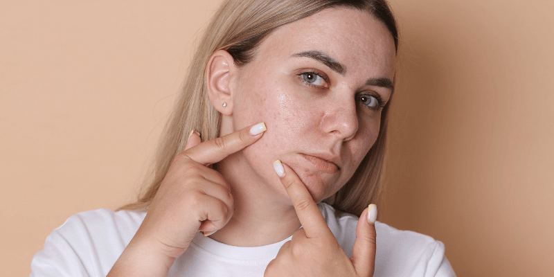 خارش یا قرمزی پوست