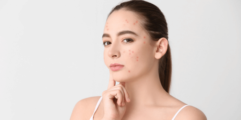 چرا نباید مشکلات پوستی را نادیده بگیریم؟