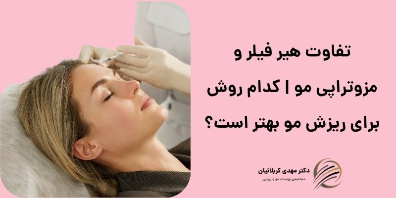 تفاوت هیر فیلر و مزوتراپی مو