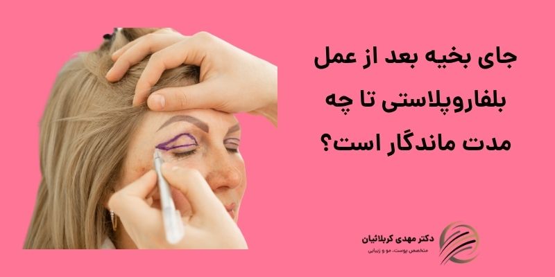 جای بخیه بعد از عمل بلفاروپلاستی