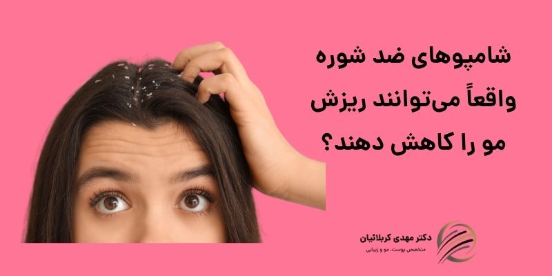 شامپوهای ضد شوره